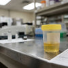 Will Delta 8 Show On Drug Test? What You Need to Know